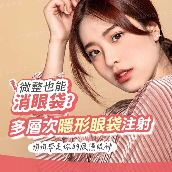 免動刀處理浮腫眼袋 多層次隱形眼袋改善眼下老化│雅丰美膚診所陳昱璁醫師
