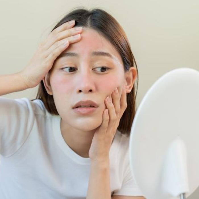 醫師分享護膚指南告別泛紅、痘痘│皮膚專科毛奕甯醫師