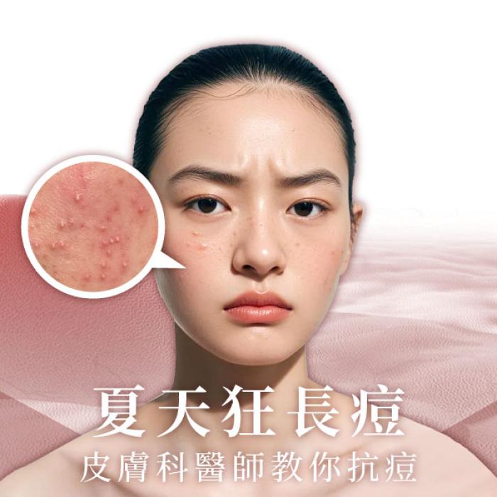 夏天狂長痘,皮膚科醫師教你抗痘!