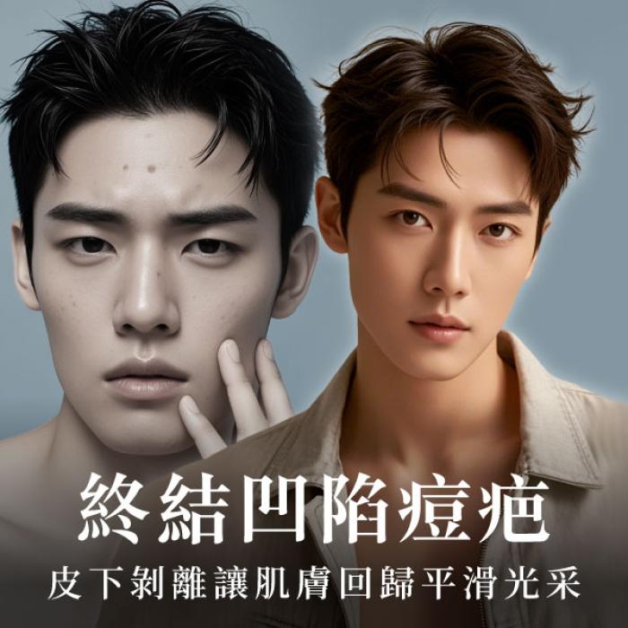 皮下剝離讓肌膚回歸平滑光采!皮膚專科毛奕甯醫師 | 雅丰麗緻美膚診所
