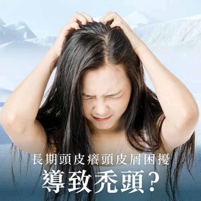 長期頭皮癢頭皮屑困擾導致禿頭?整形外科黃智威醫師 | 雅丰絲漾生髮診所