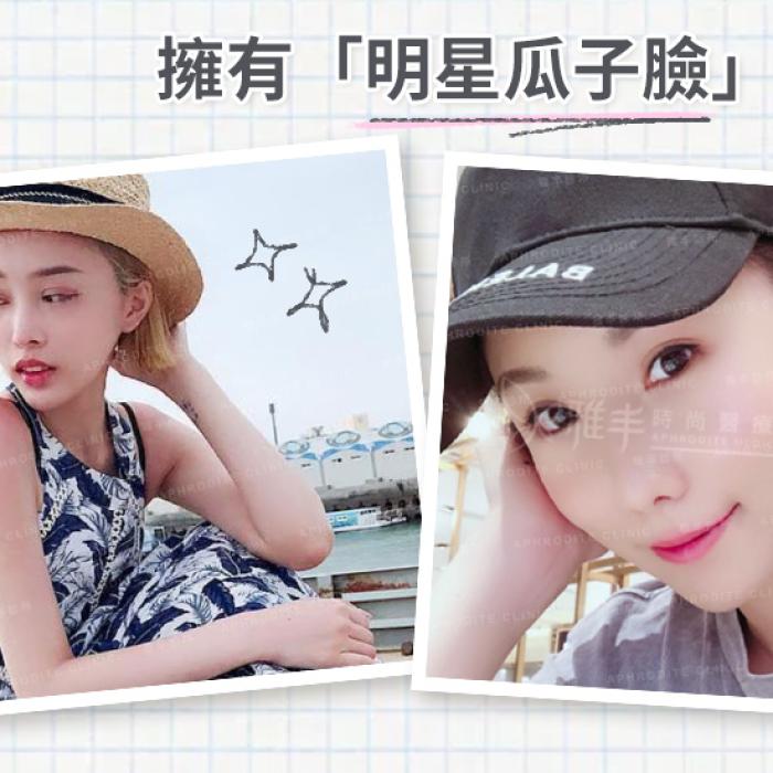 讓擁有明星瓜子臉不再是遙不可及