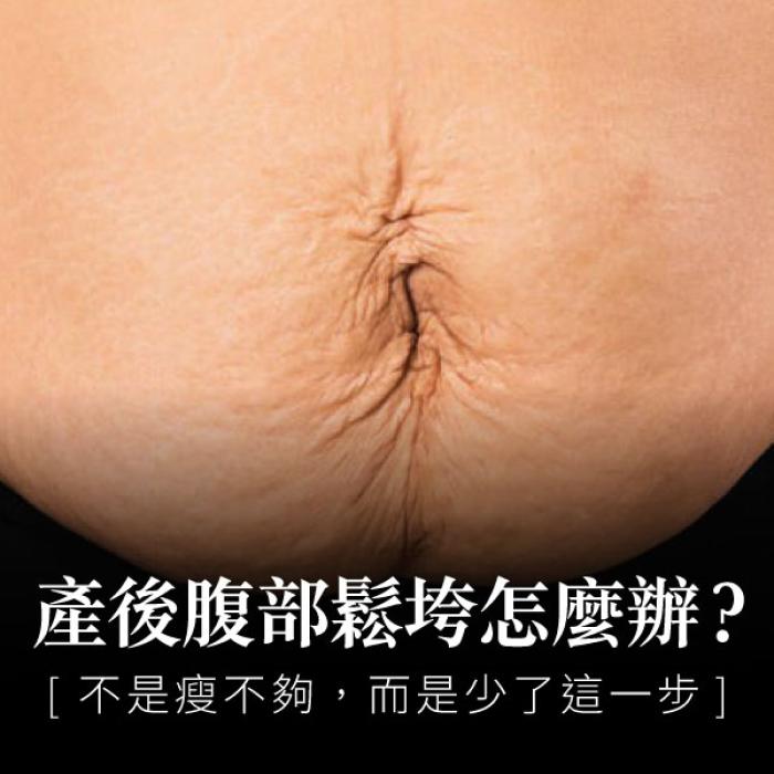 產後腹部鬆垮怎麼辦?不是瘦不夠,而是少了這一步。整形外科余宗宸醫師│雅丰席睿診所