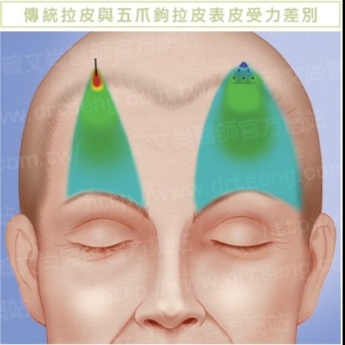 dr.tseng_pressrelease16.jpg