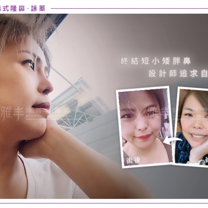 nosecase_1050921_16.jpg