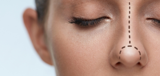 service_surgery_rhinoplasty_cover
