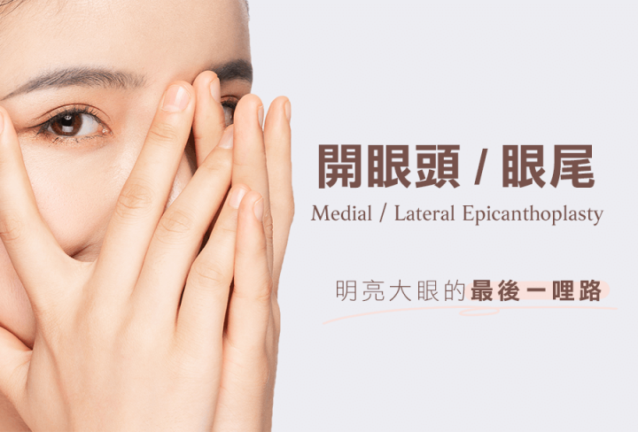 開眼頭眼尾手術