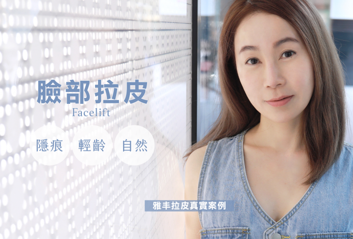 臉部拉皮手術,雅丰診所