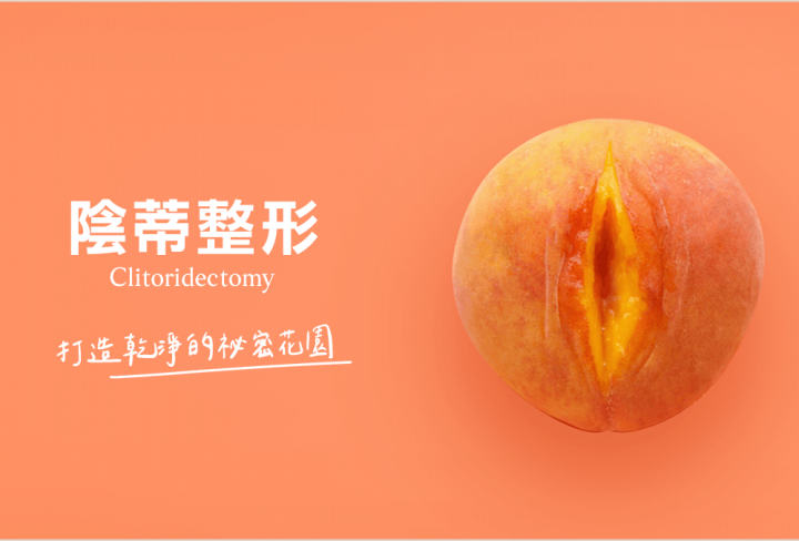 陰蒂手術