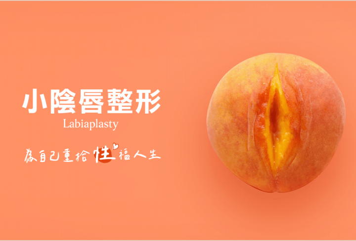 小陰唇整形