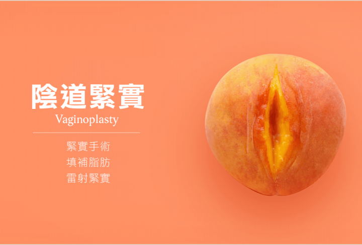 陰道緊實手術
