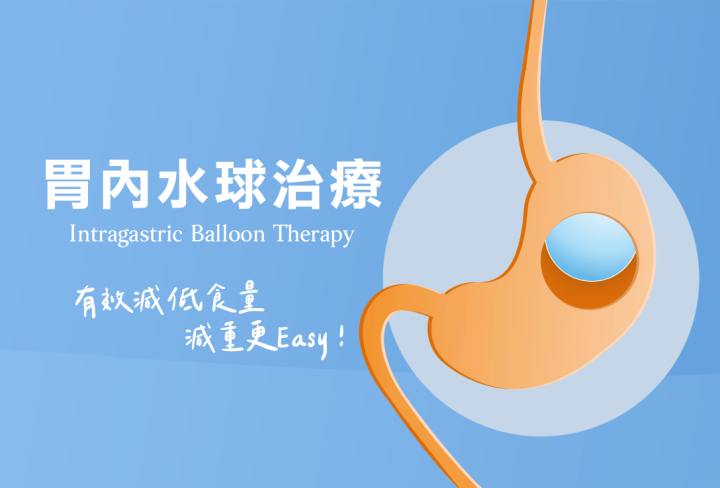 胃內水球治療