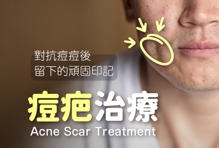 痘疤治療, 雅丰診所