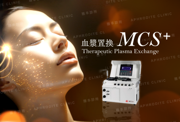 MCS+, 血漿置換