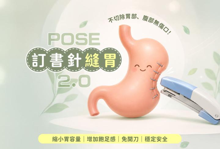 POSE 2.0 訂書針縫胃