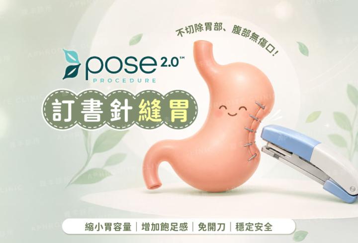 POSE 2.0 訂書針縫胃