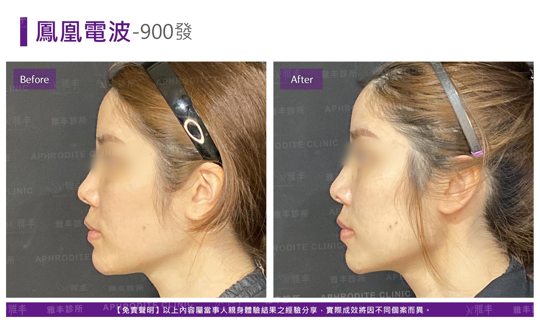 鳳凰電波-case05-L90.jpg