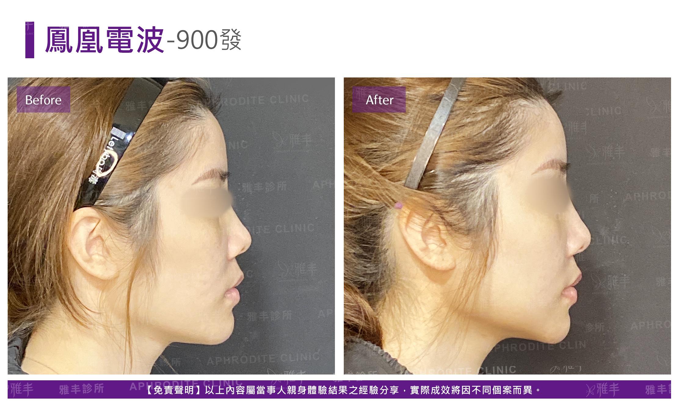 鳳凰電波-case05-R90.jpg