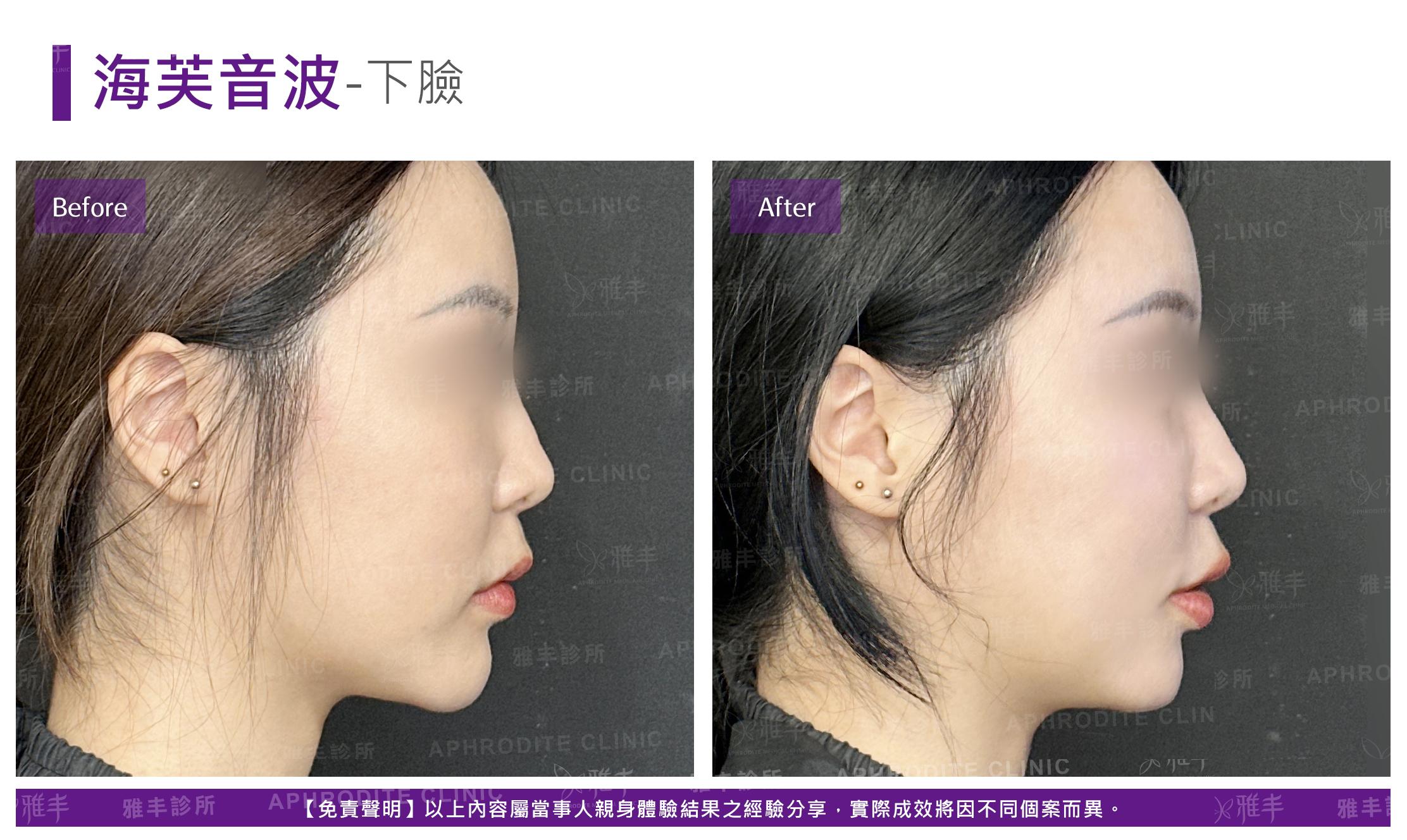 I-2-10-case1-R.jpg