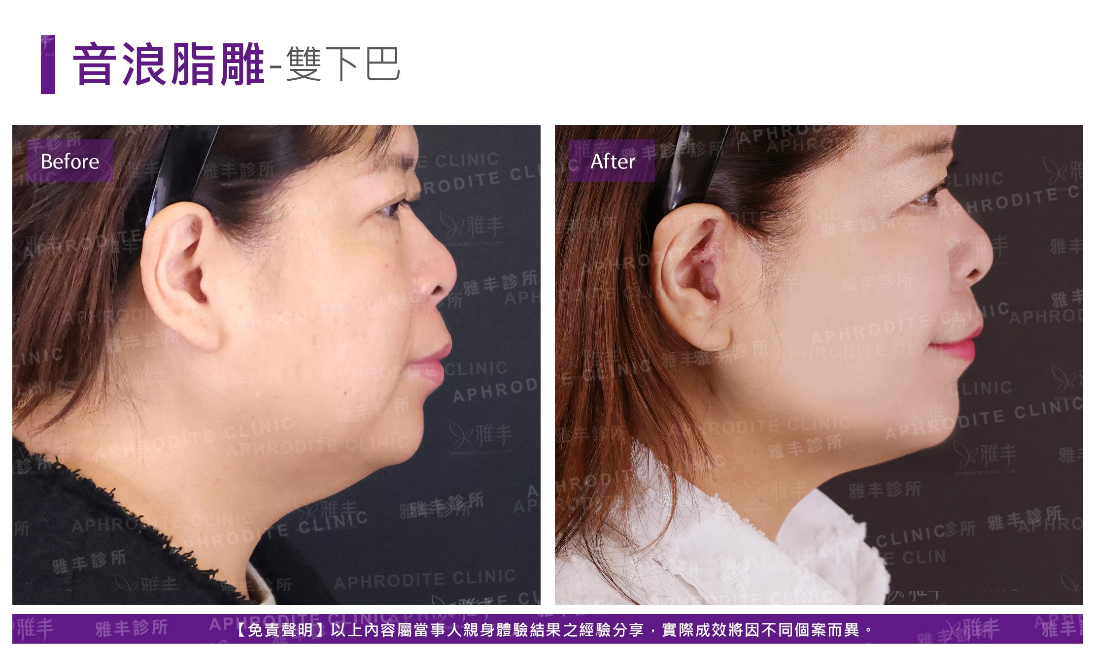 S-1-11-case2-R90.jpg