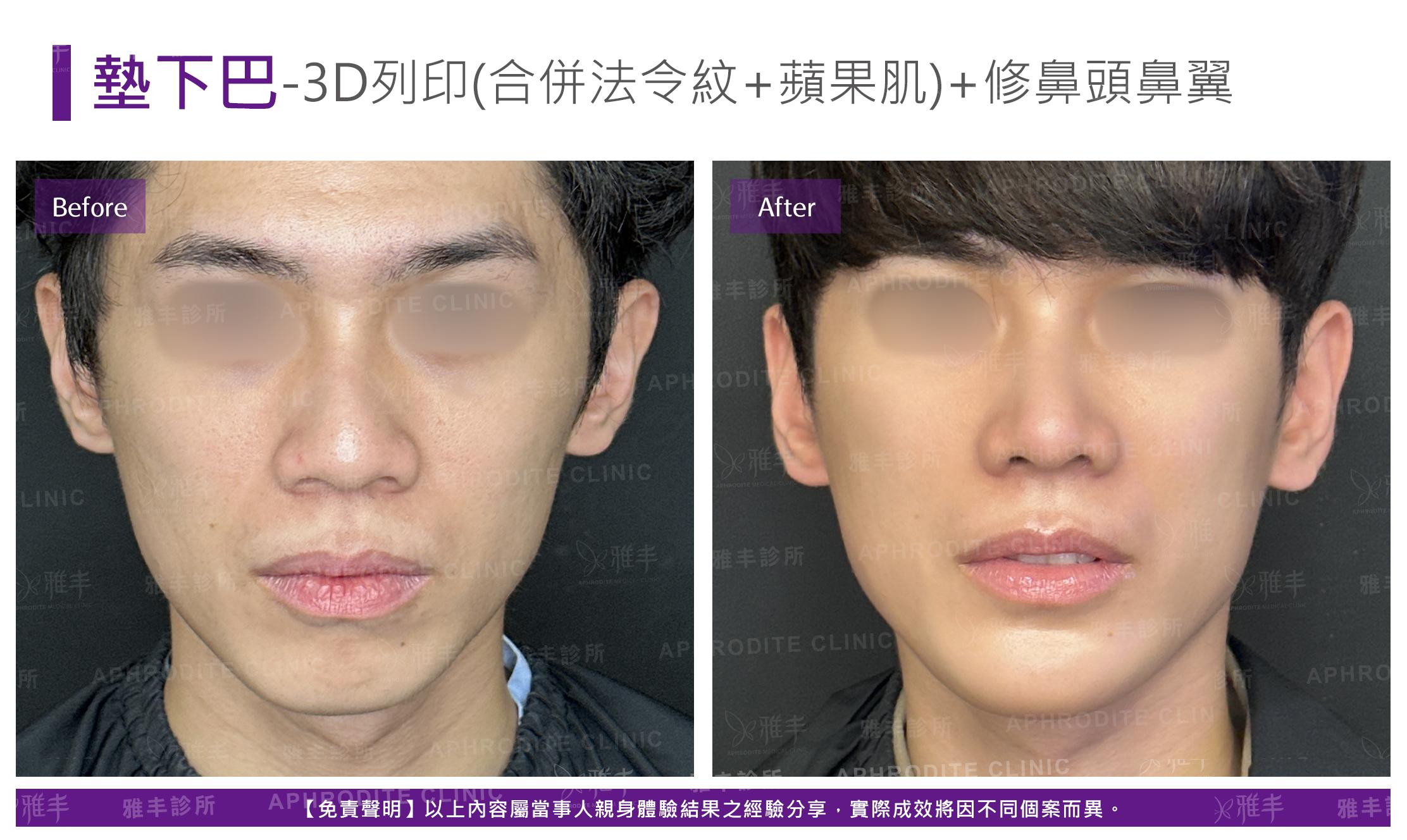 3D列印-case7-F.jpg