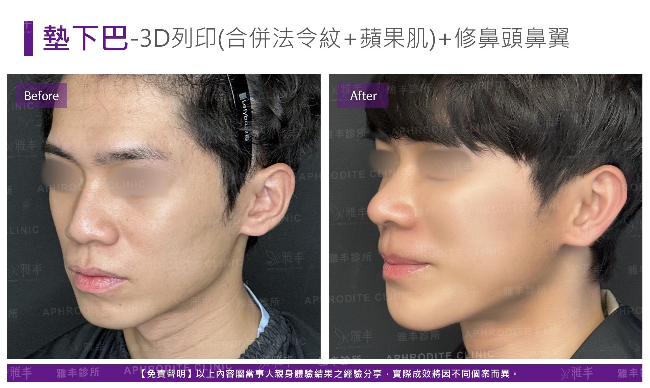 3D列印-case7-L45.jpg