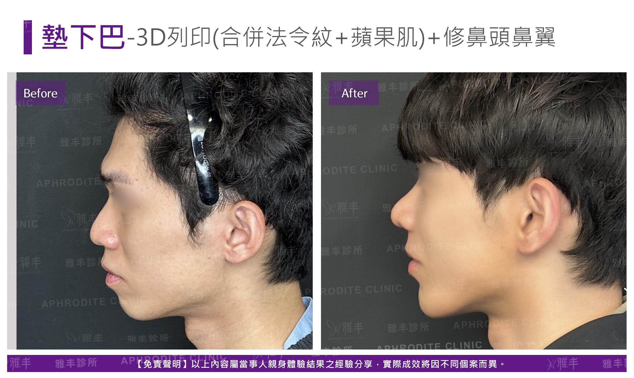 3D列印-case7-L90.jpg