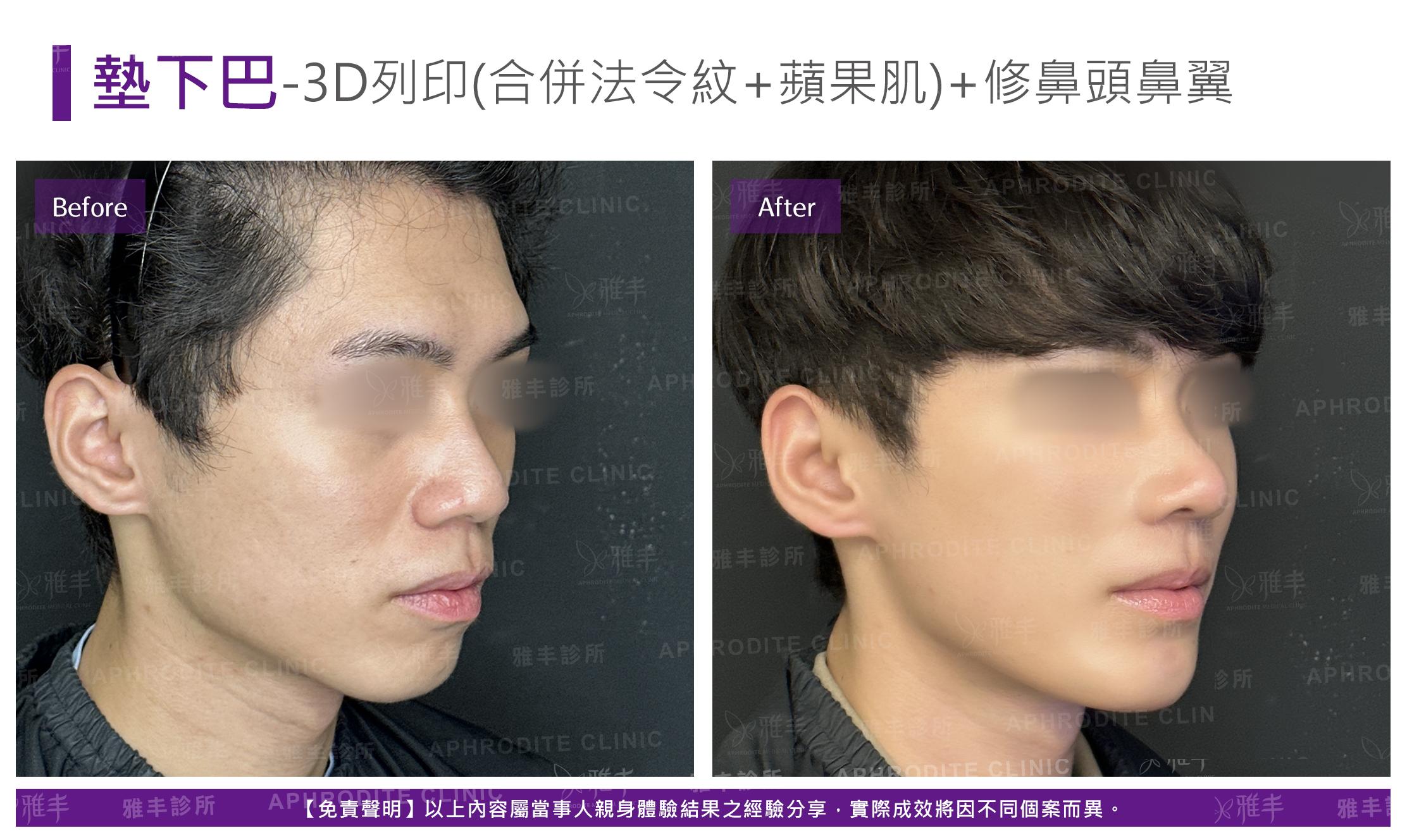 3D列印-case7-R45.jpg 