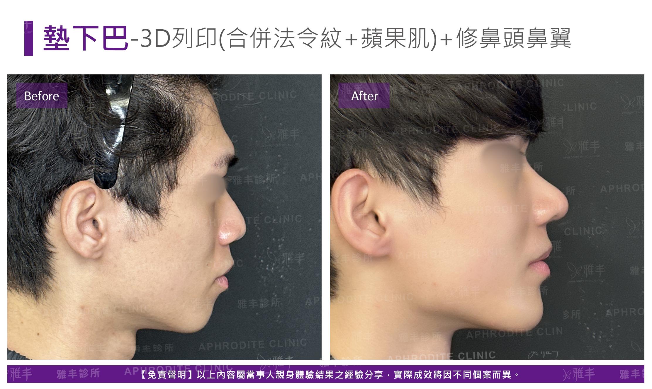 3D列印-case7-R90.jpg