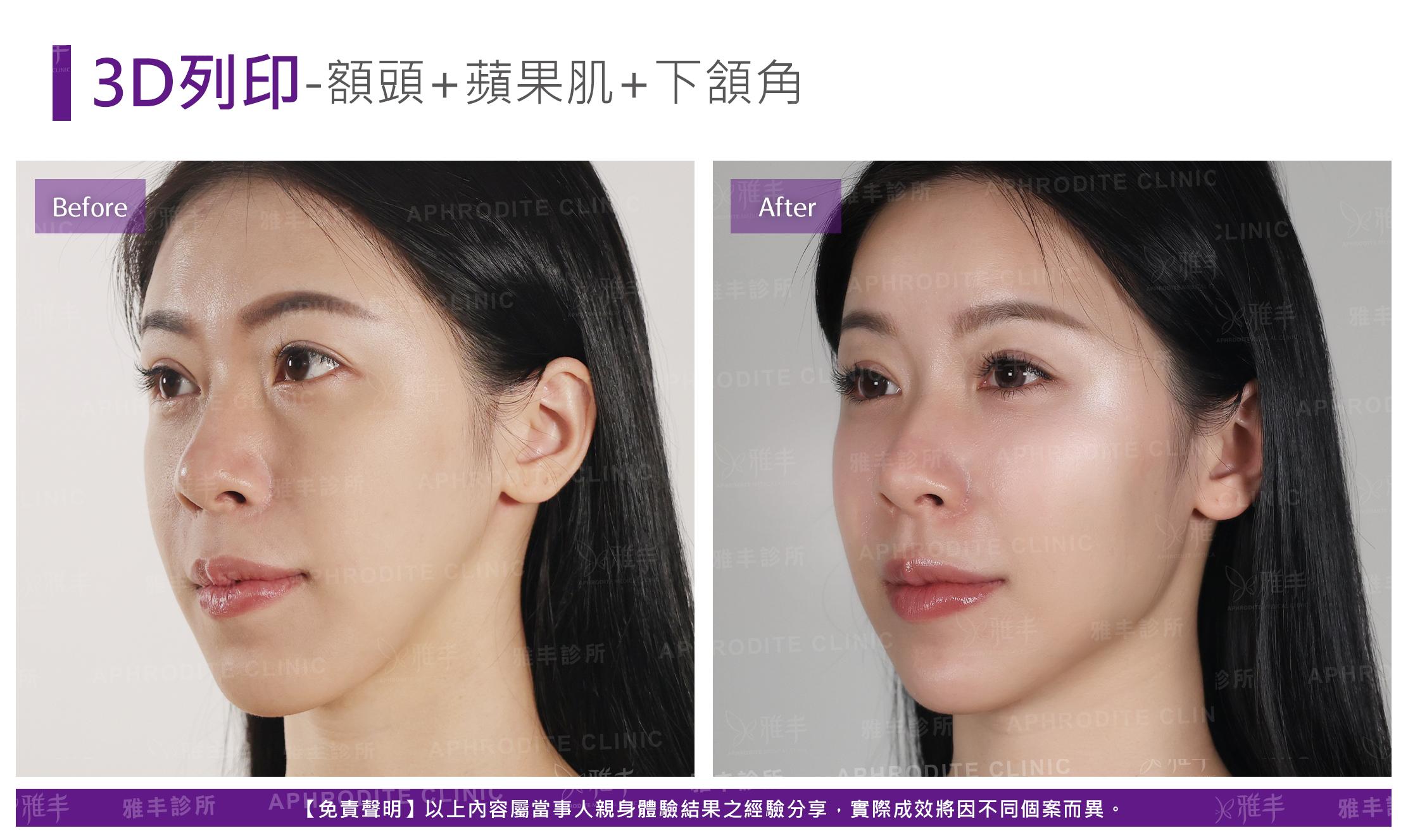 3D列印-case5-L45.jpg