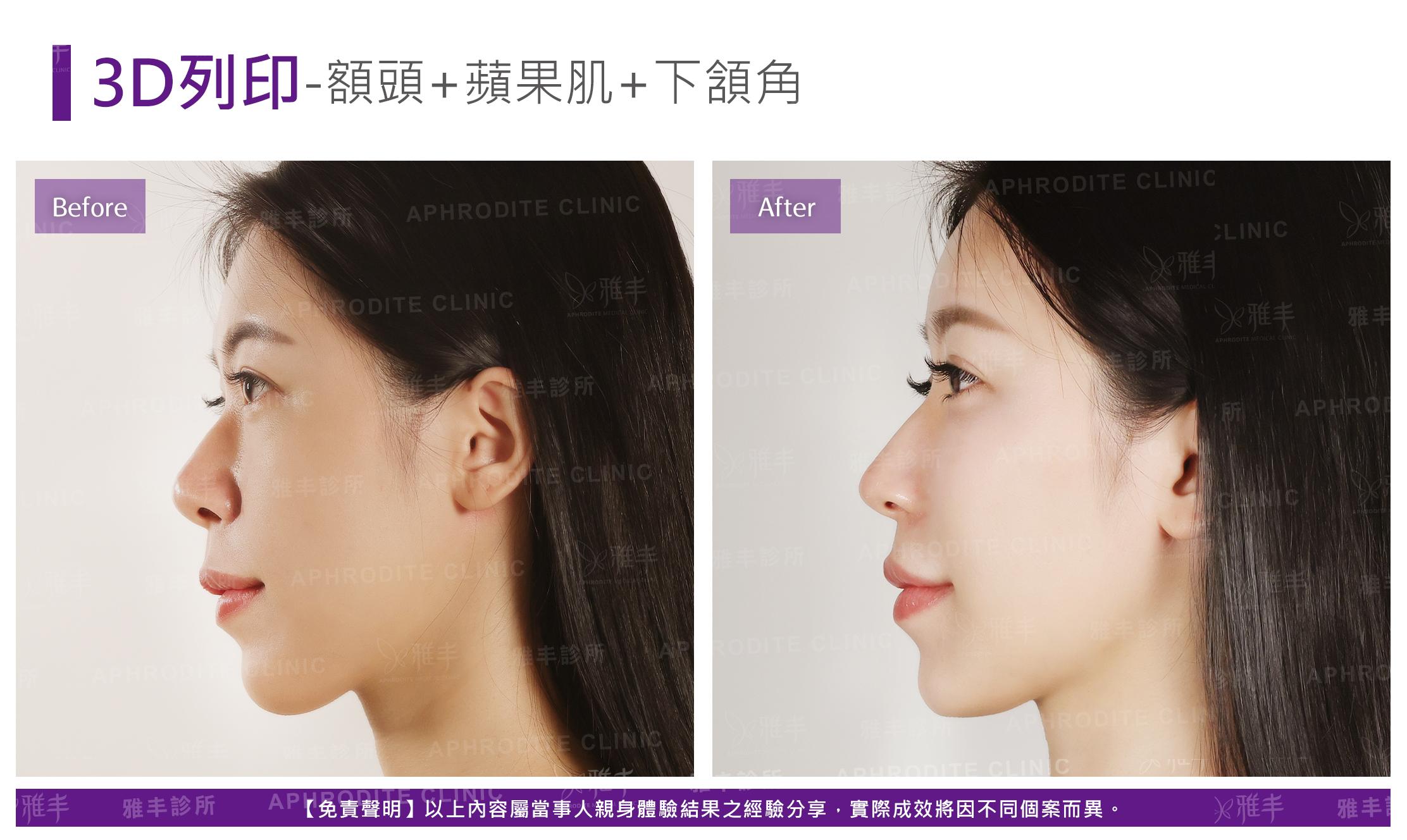 3D列印-case5-L90.jpg