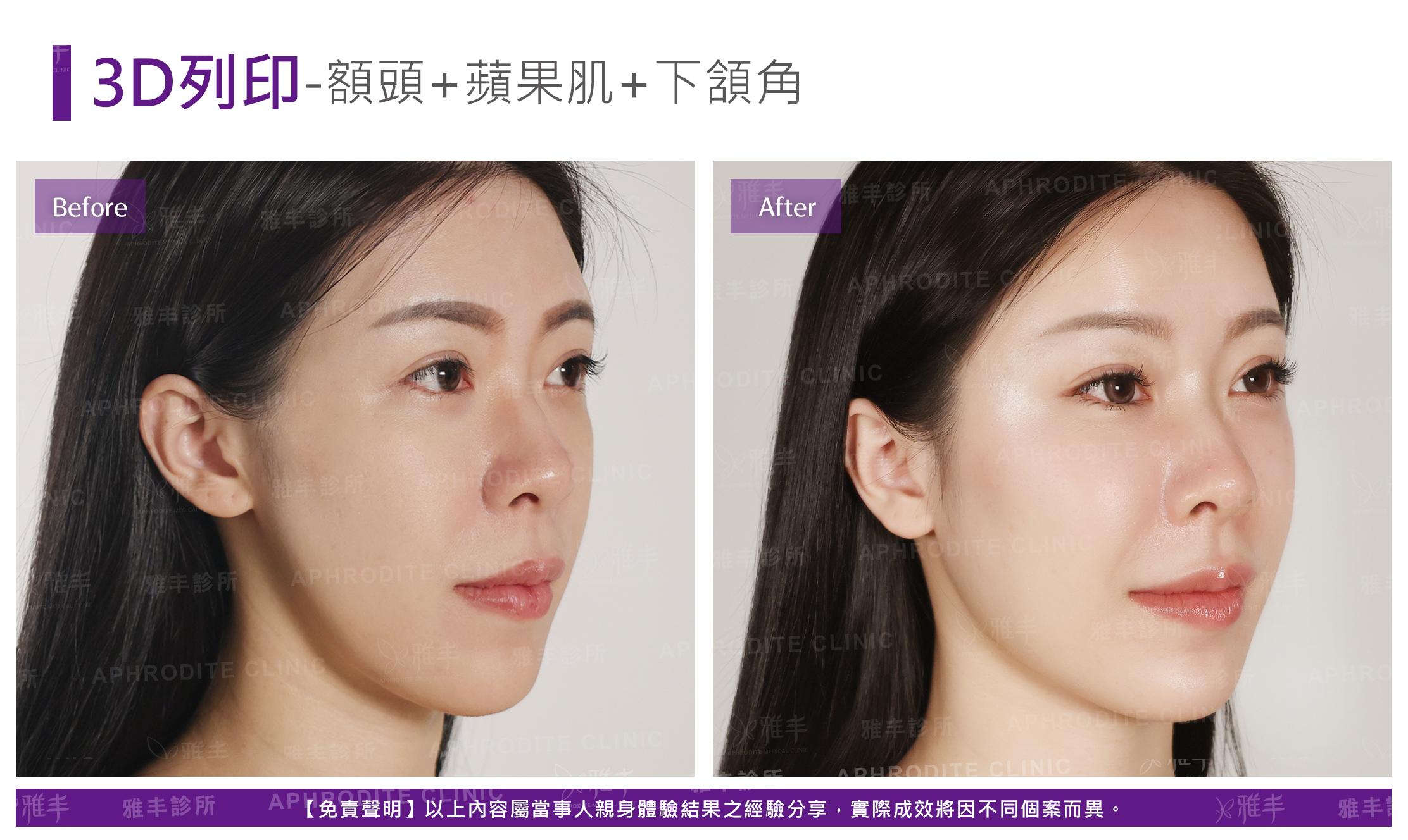 3D列印-case5-R45.jpg