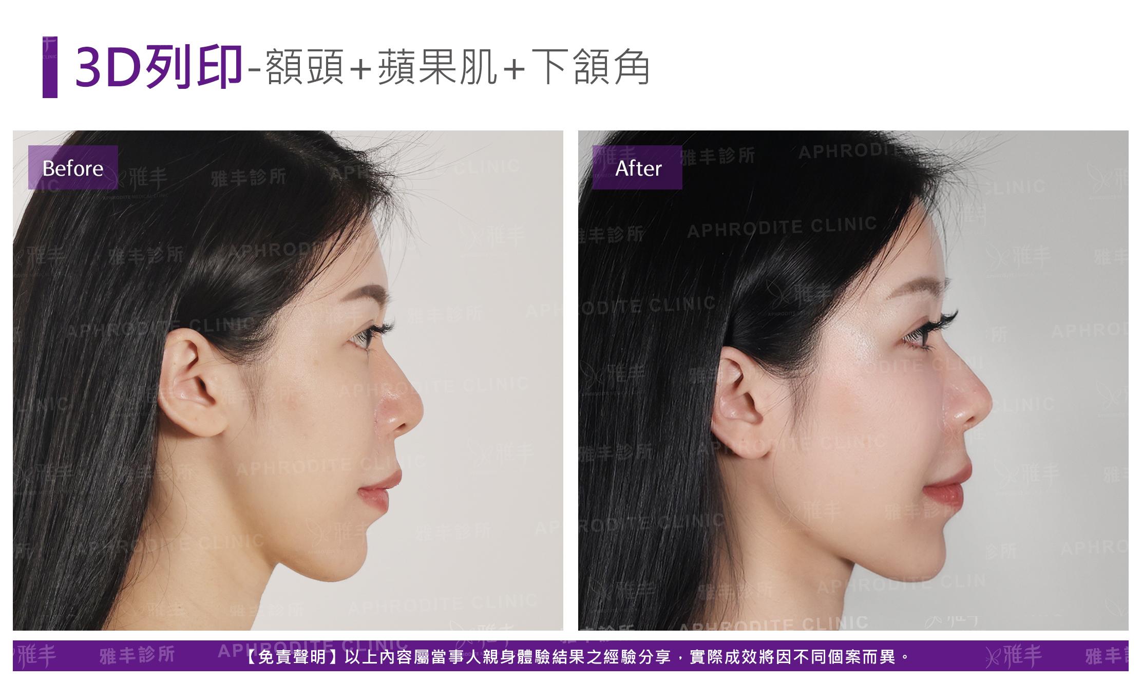 3D列印-case5-R90.jpg