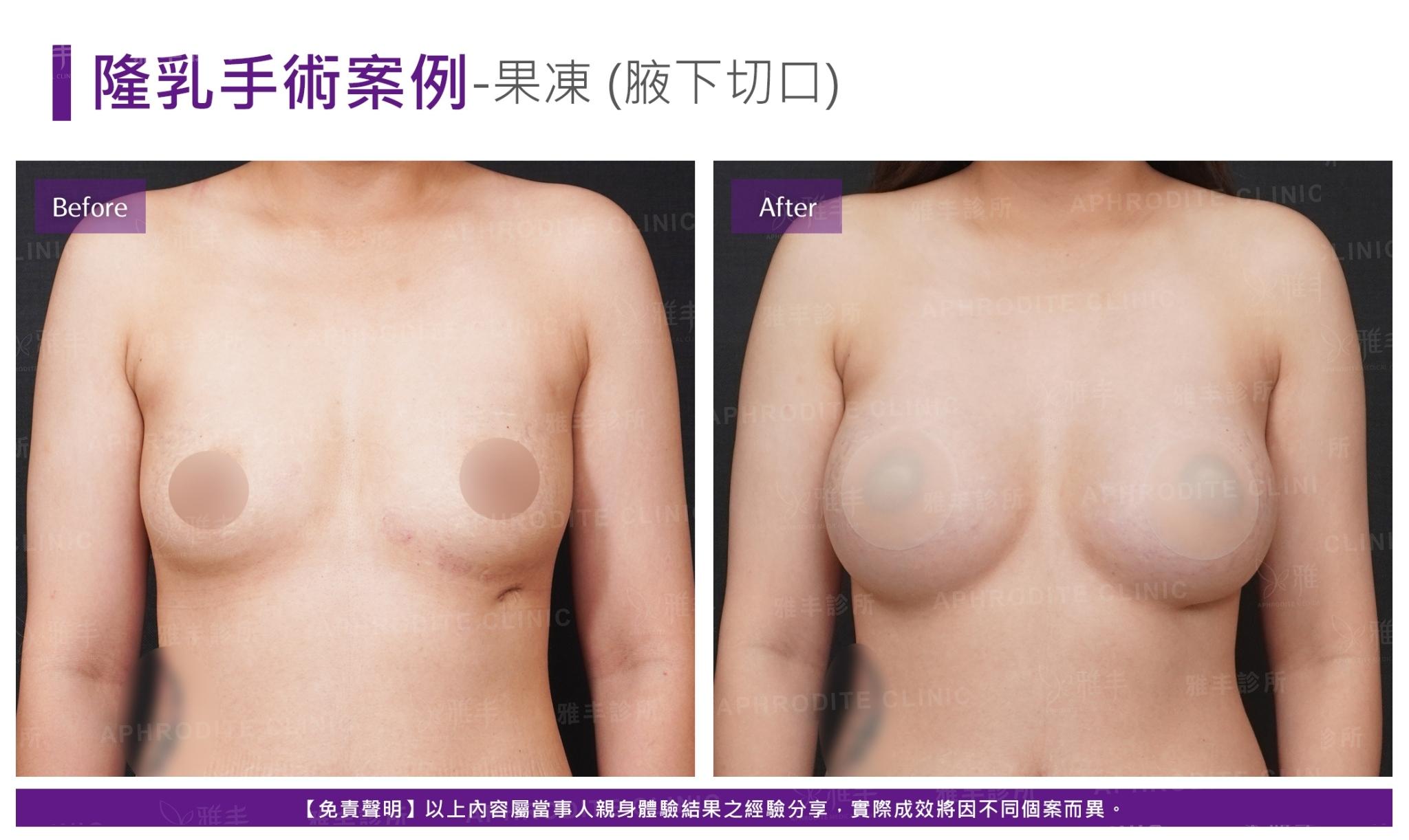 S-2-1-2-case19-F(果凍)