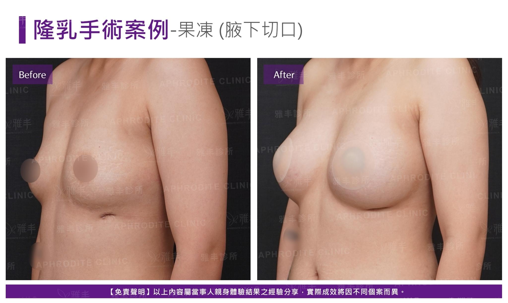 S-2-1-2-case19-L45(果凍)
