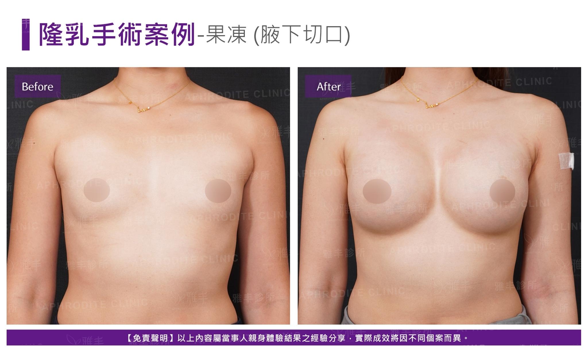 S-2-1-2-case21-F(果凍)