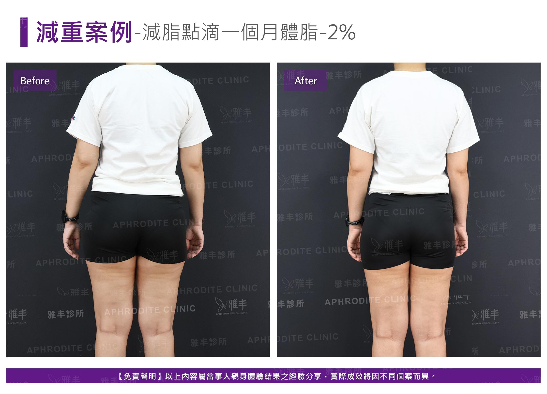 減重案例-case10-B.jpg