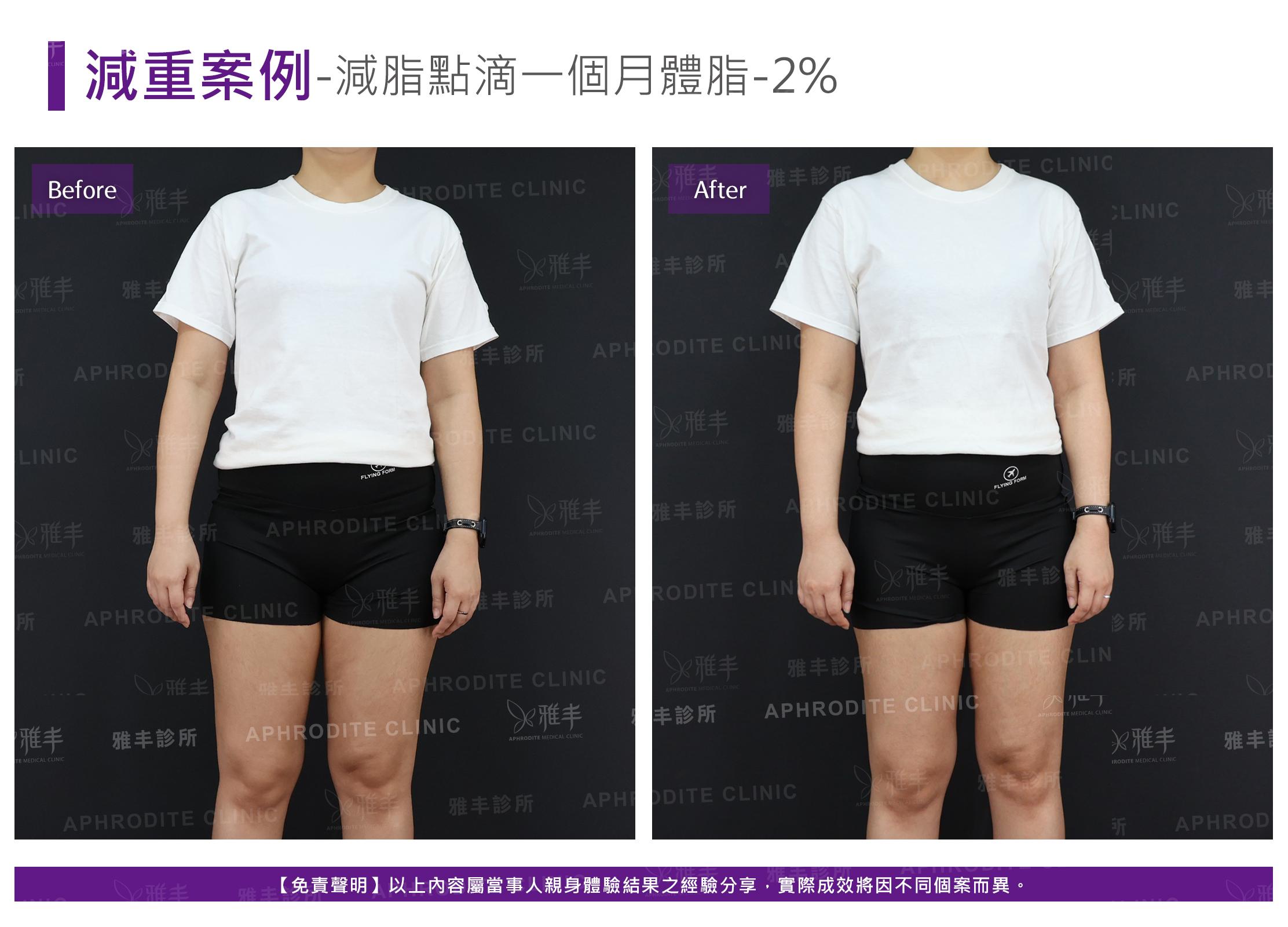 減重案例-case10-F.jpg