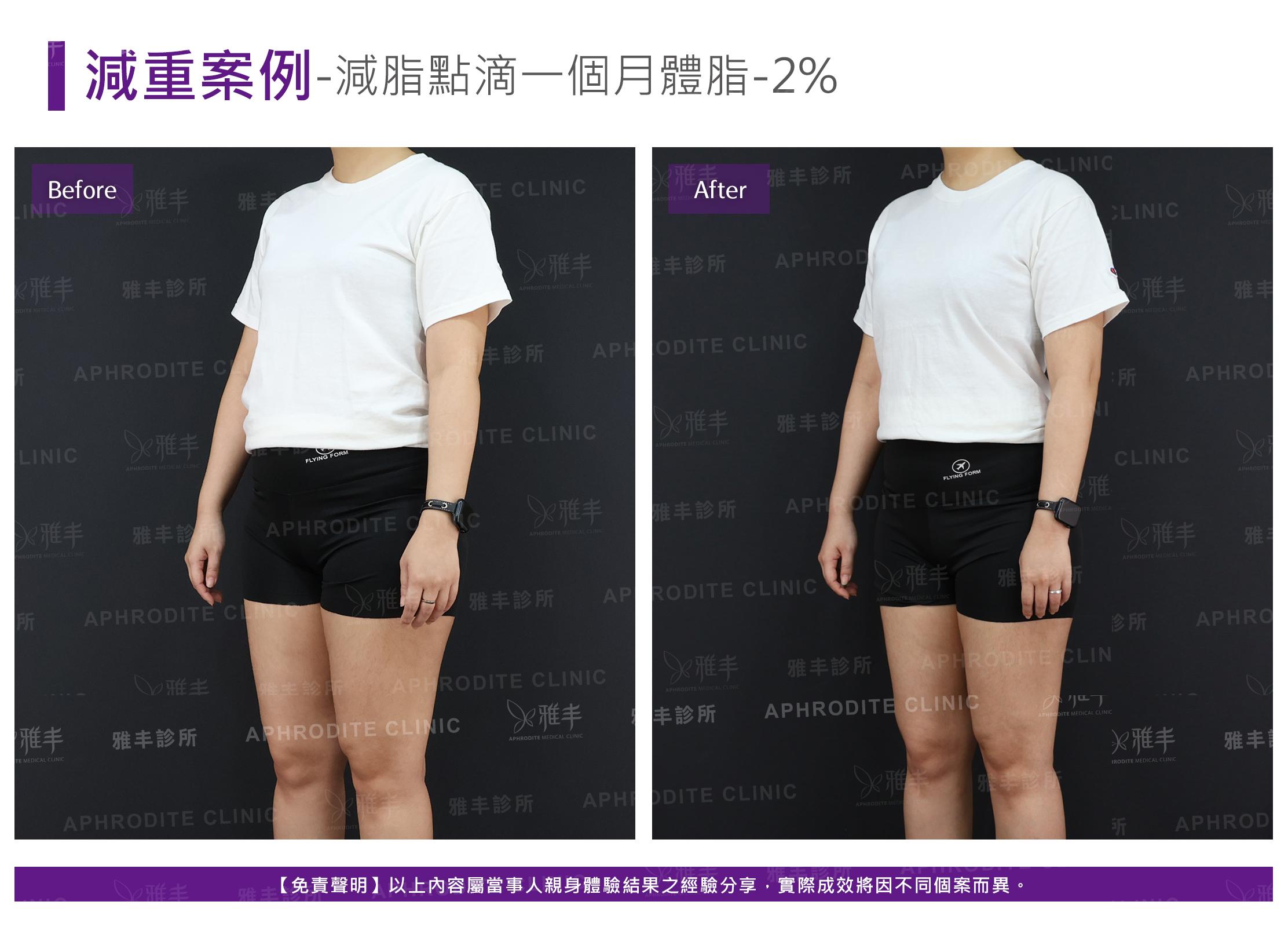減重案例-case10-L45.jpg