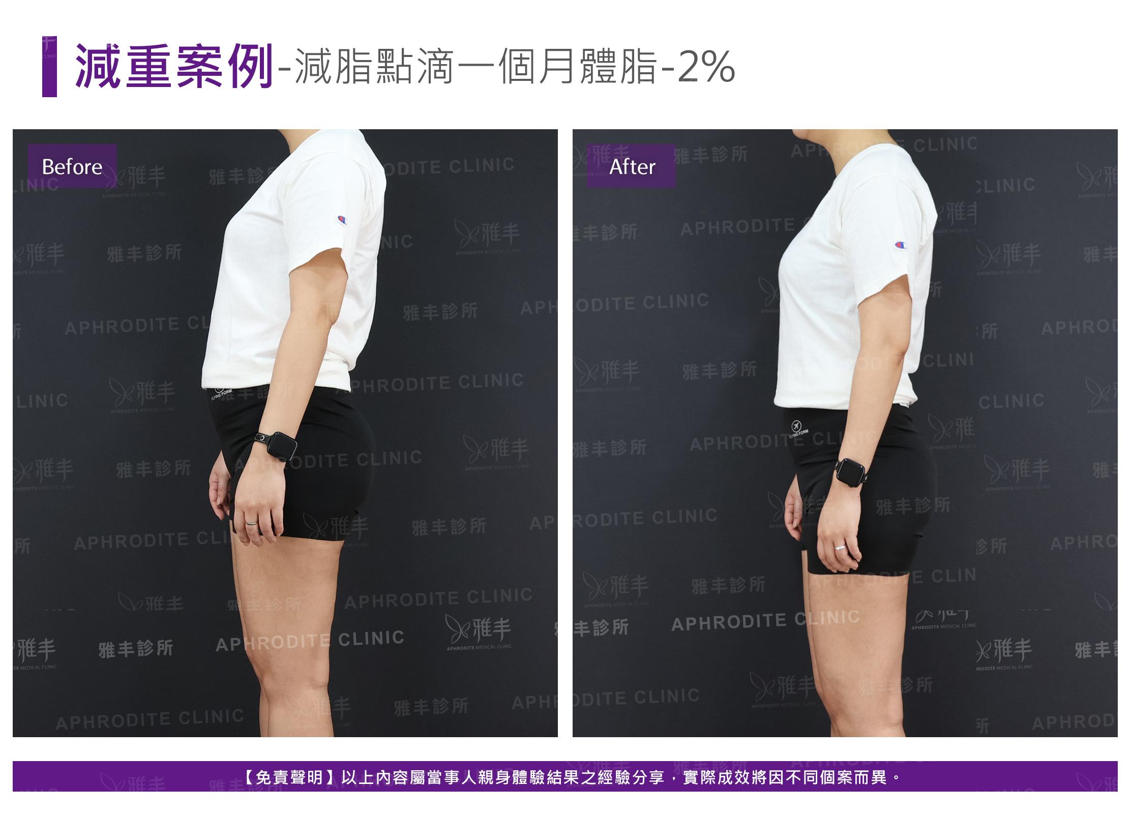 減重案例-case10-L90.jpg