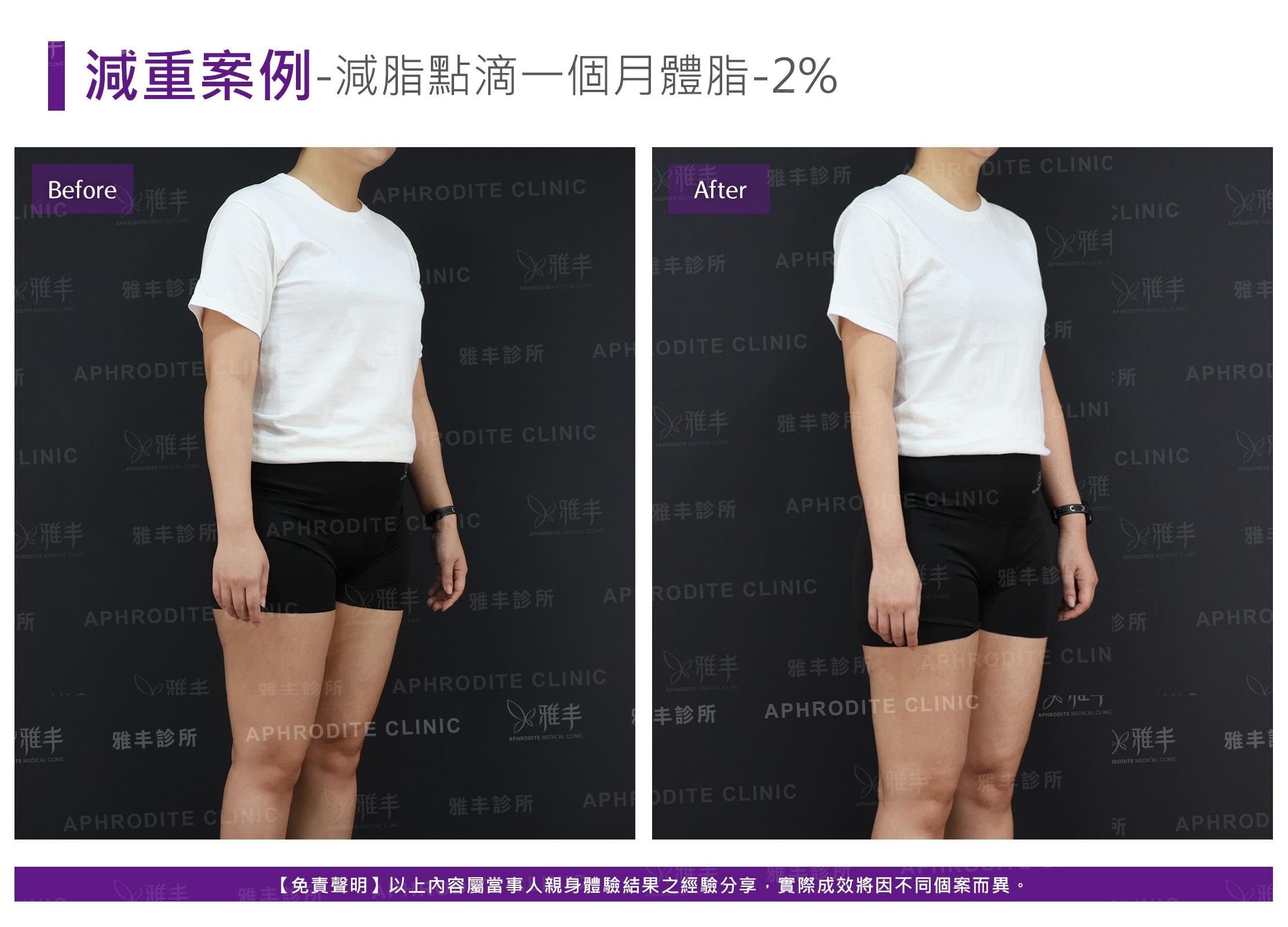 減重案例-case10-R45.jpg