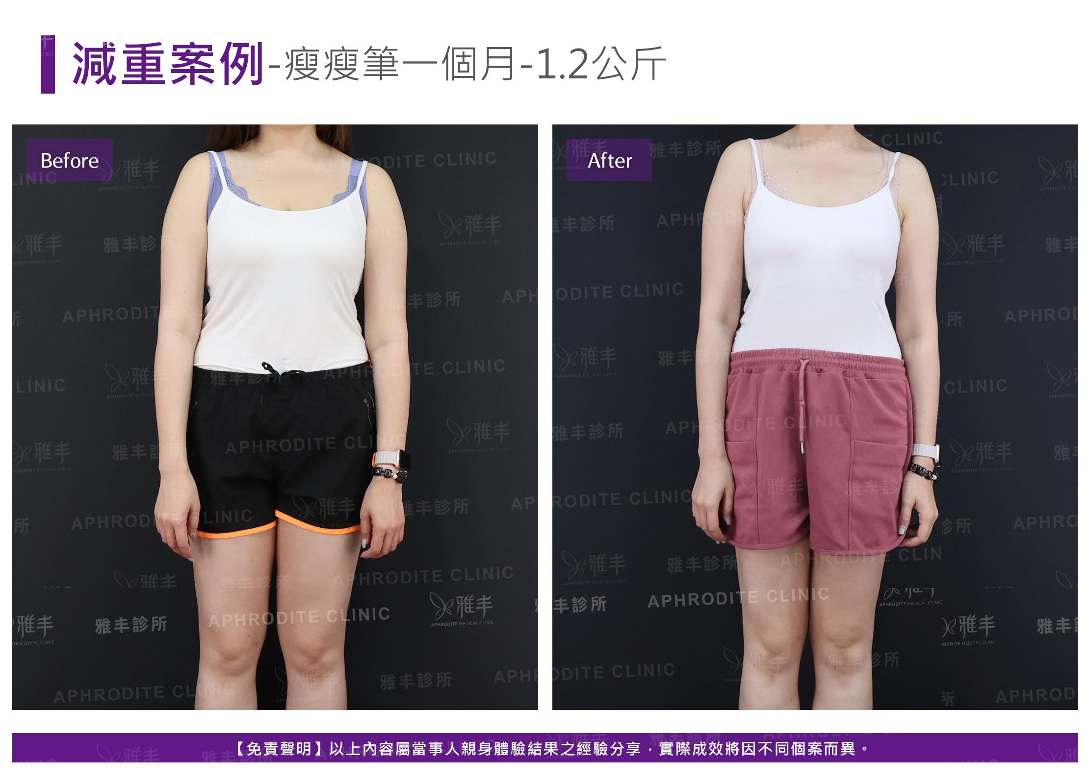 減重案例-case11-F.jpg
