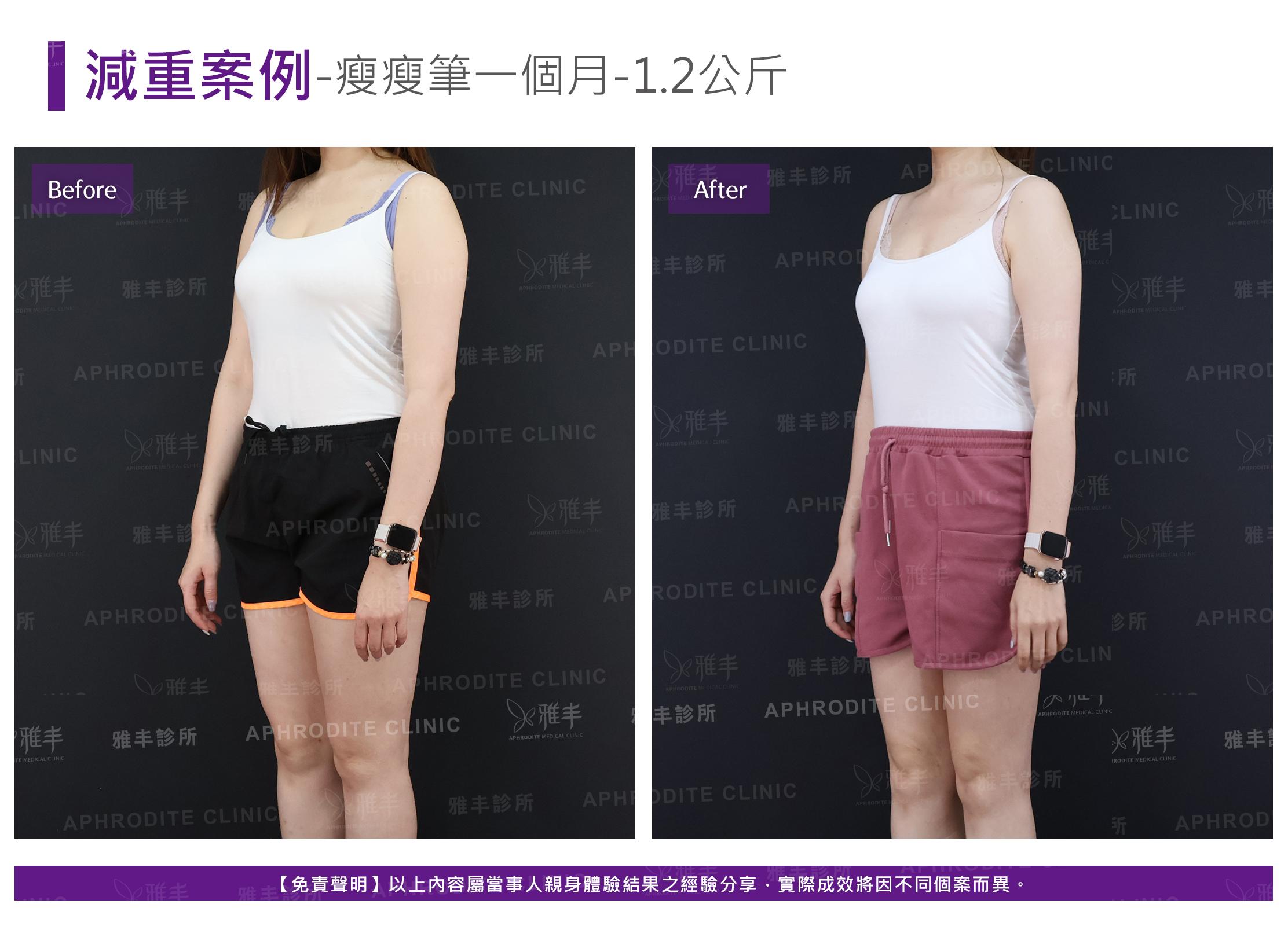 減重案例-case11-L45.jpg