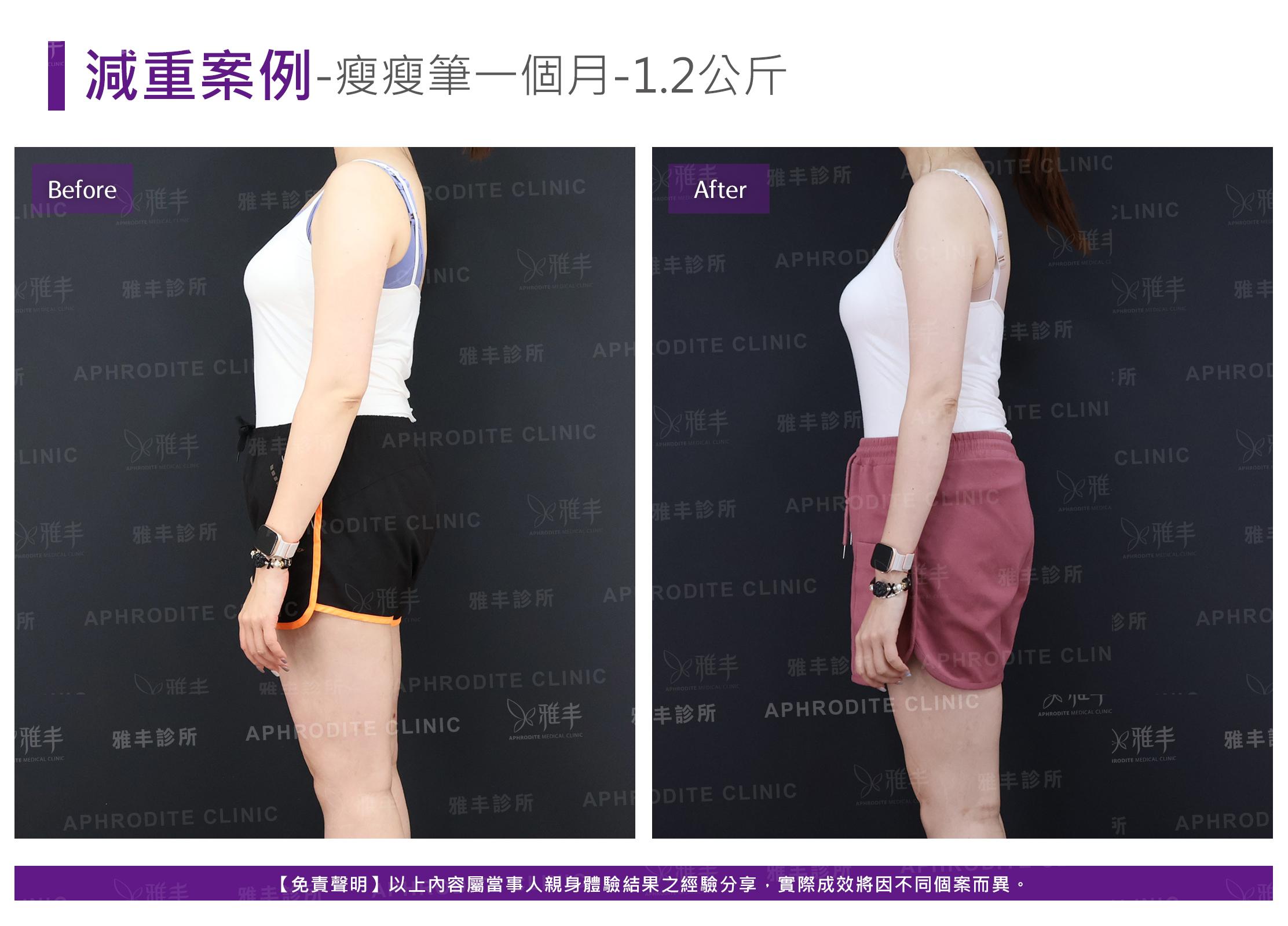 減重案例-case11-L90.jpg