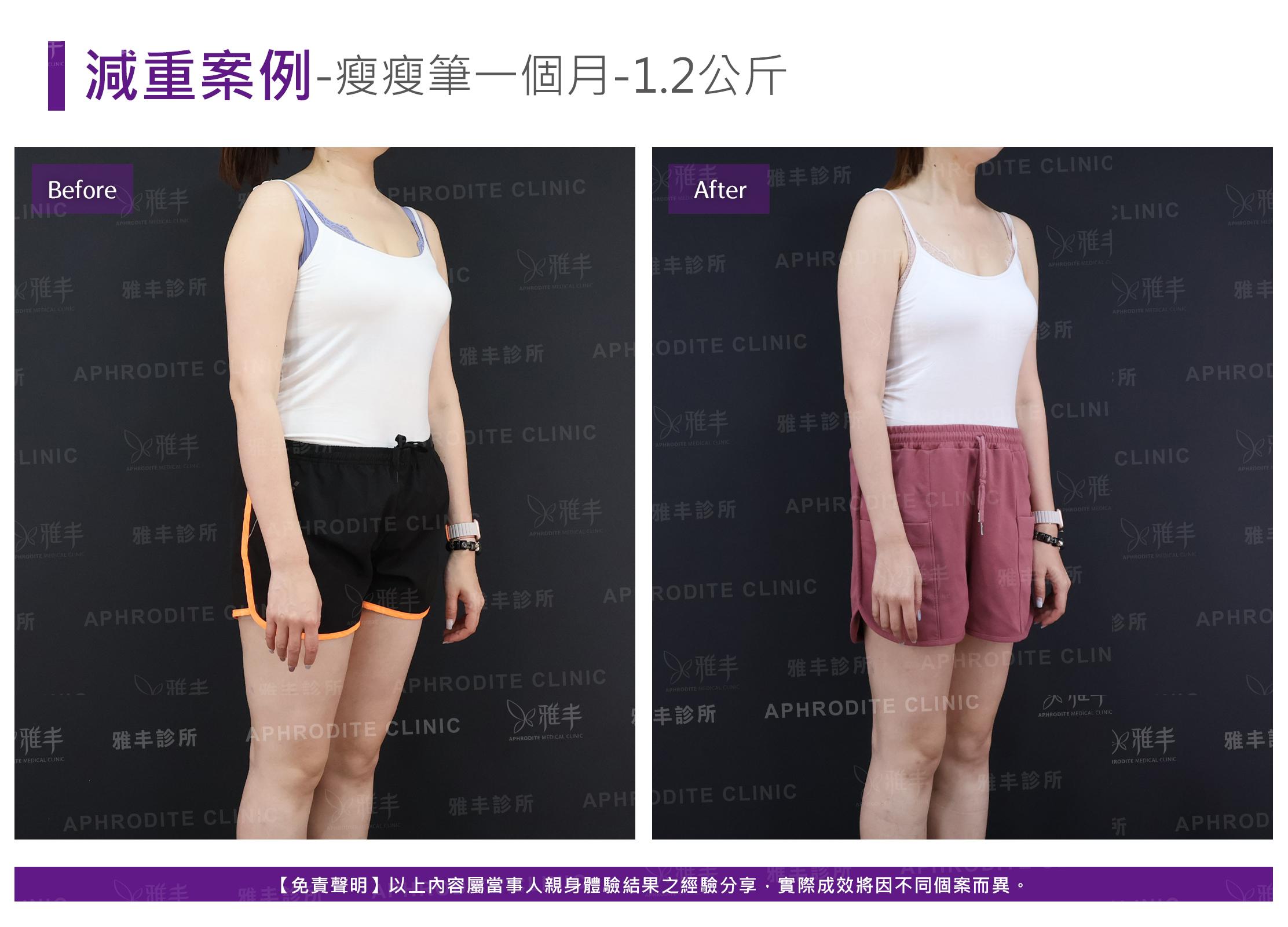 減重案例-case11-R45.jpg