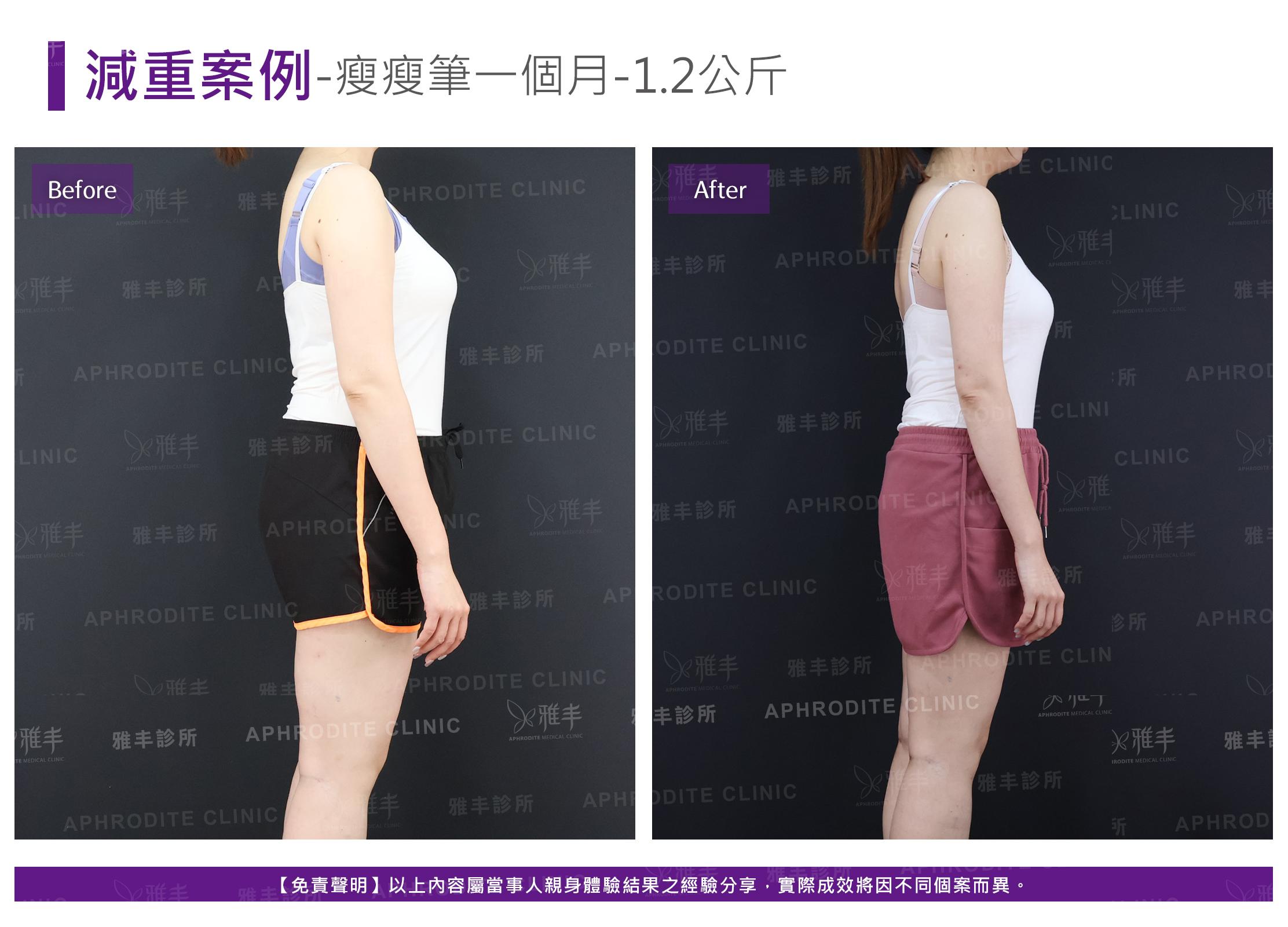 減重案例-case11-R90.jpg