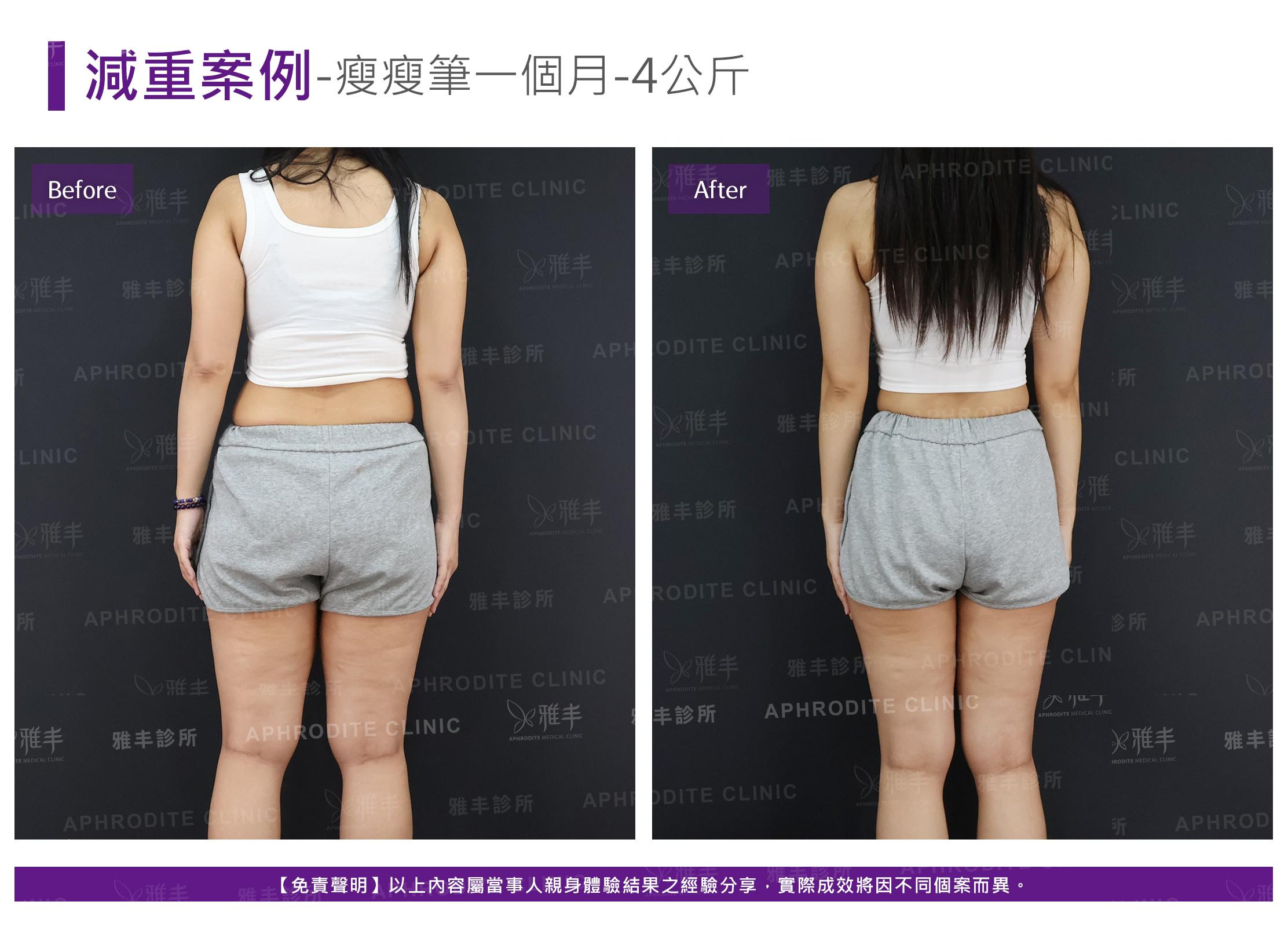 減重案例-case12-B.jpg