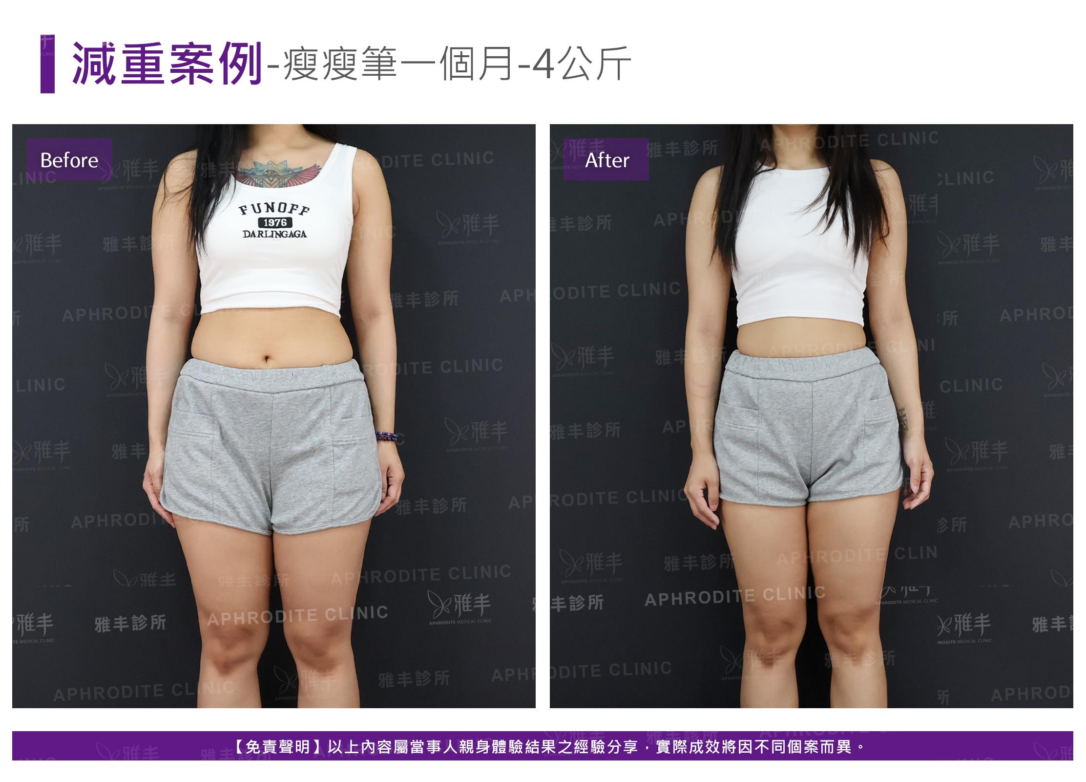 減重案例-case12-F.jpg