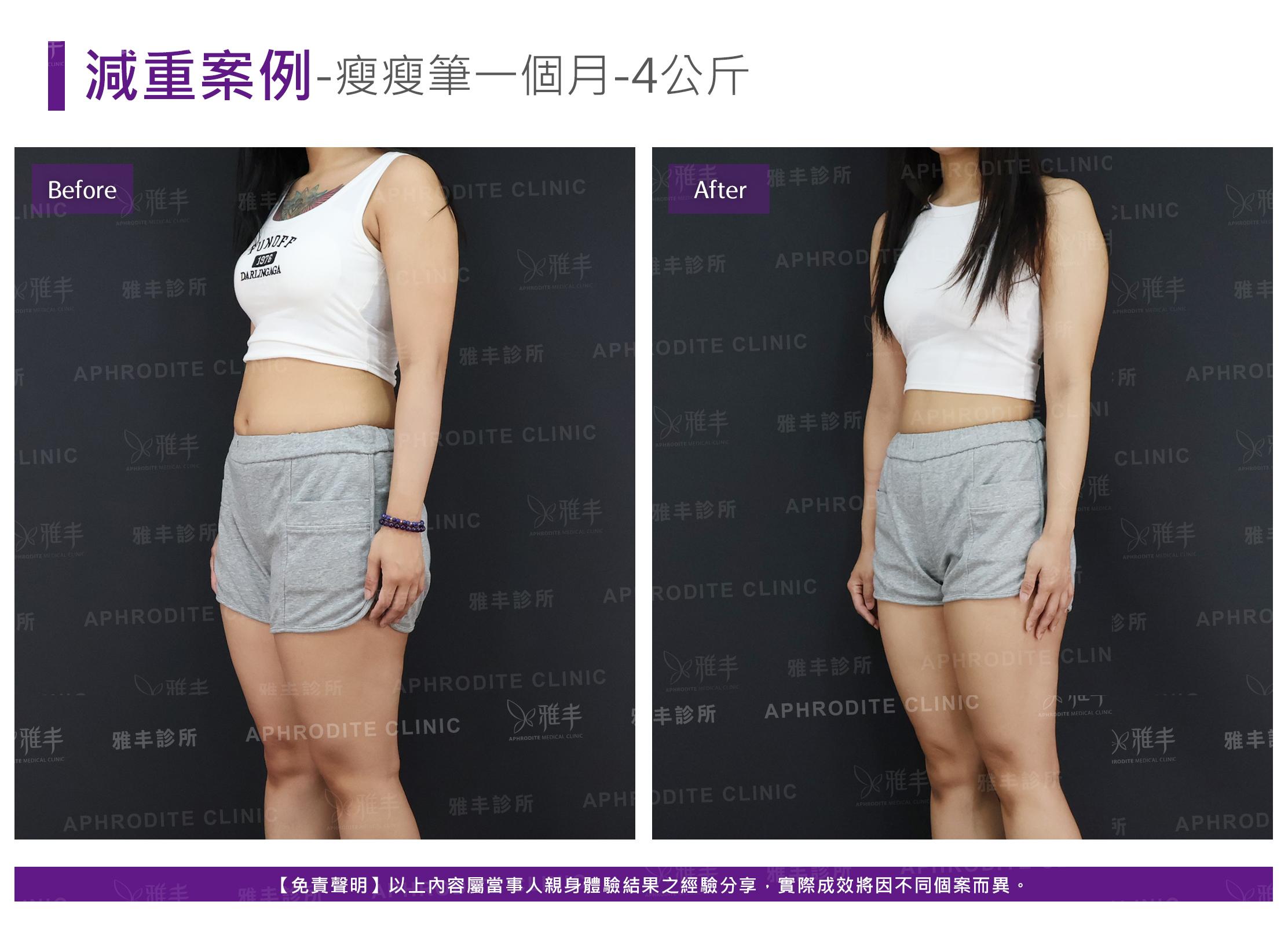 減重案例-case12-L45.jpg