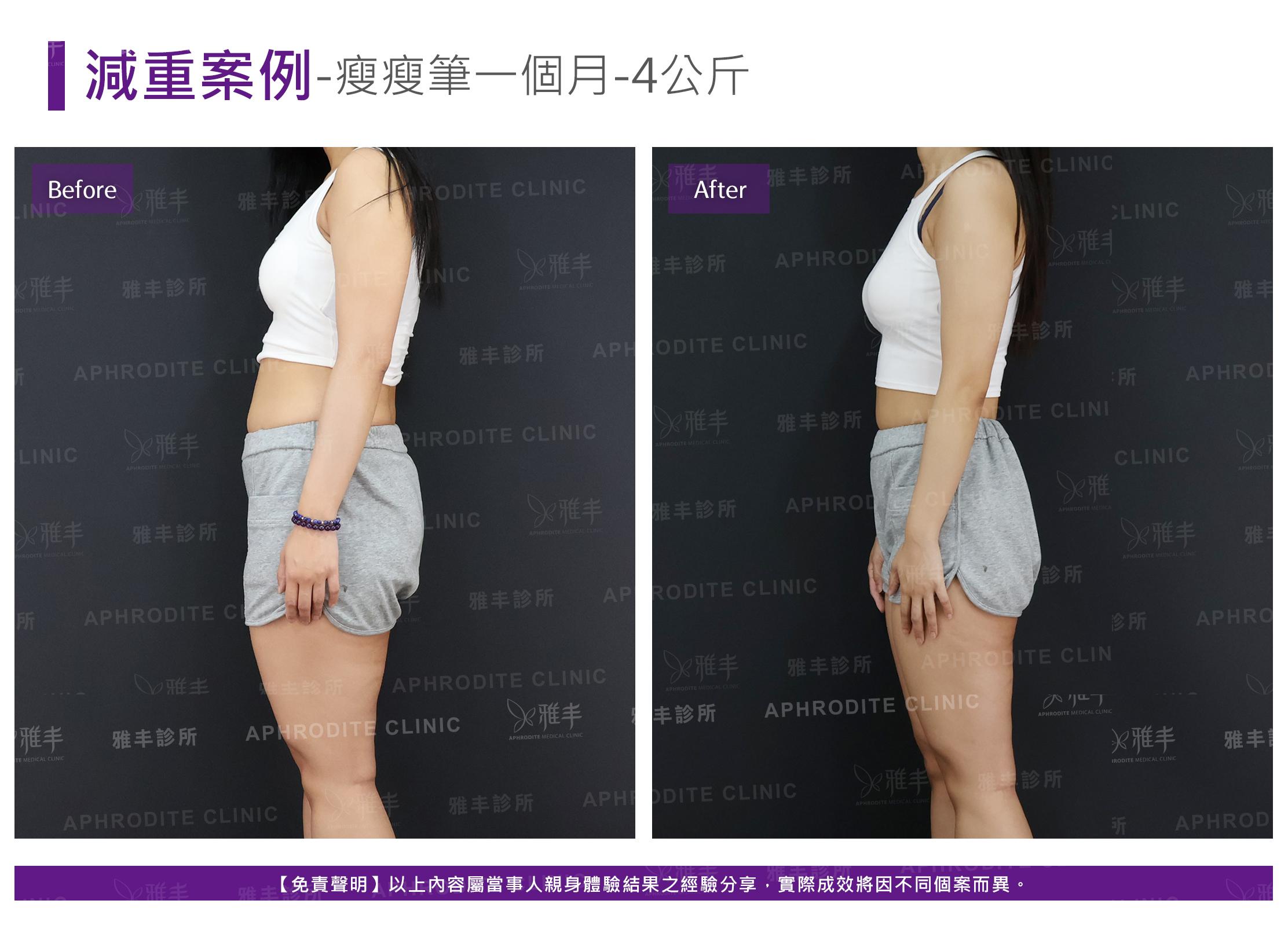 減重案例-case12-L90.jpg